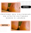 Protetor de Calcanhar em Silicone